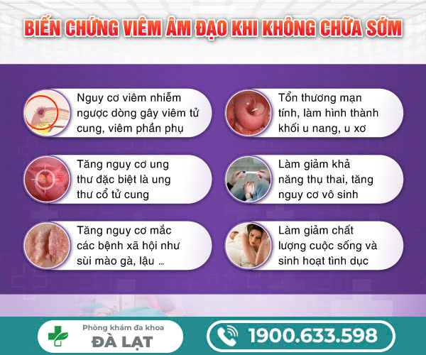 Hình ảnh minh họa